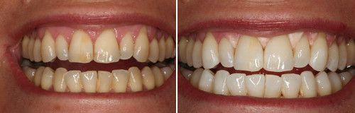 169d84593051bf03730a05e5ddda4984