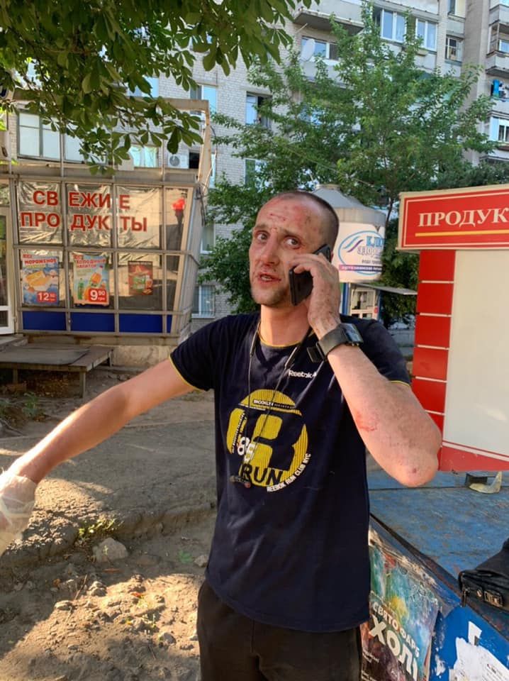 «Звериный оскал падлы»: Лысенко выдал дебошира, который избил кондуктора, чтобы не платить. Новости Днепра