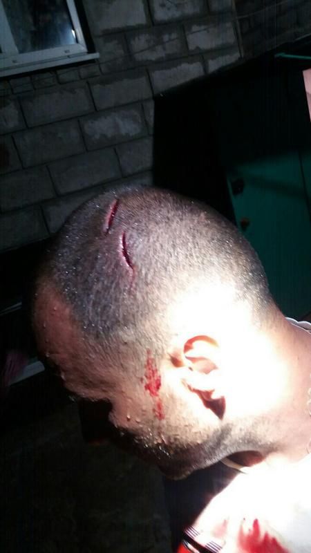 Днепрянин набросился с топором на зятя. Новости Днепра