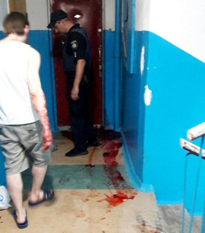 Женщину избили топором по голове. Новости Днепра