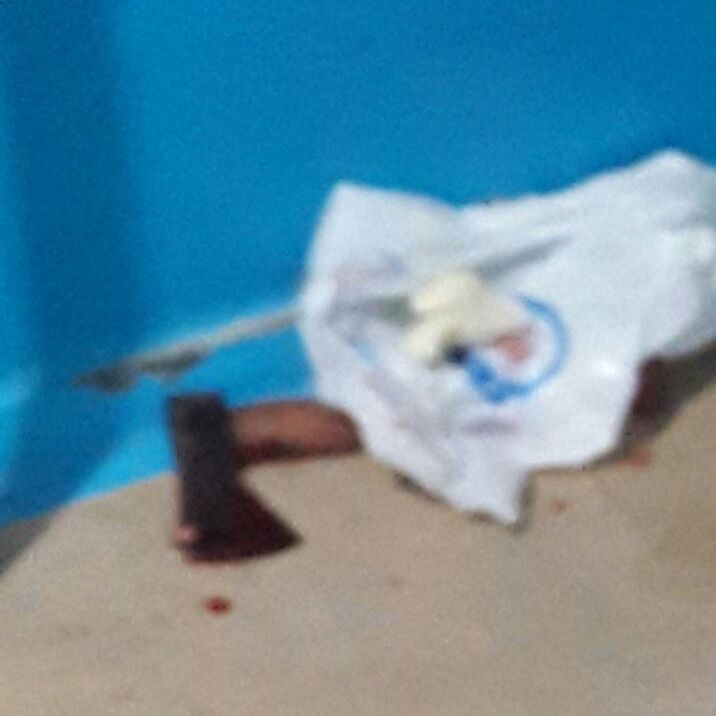 Женщину избили топором по голове. Новости Днепра