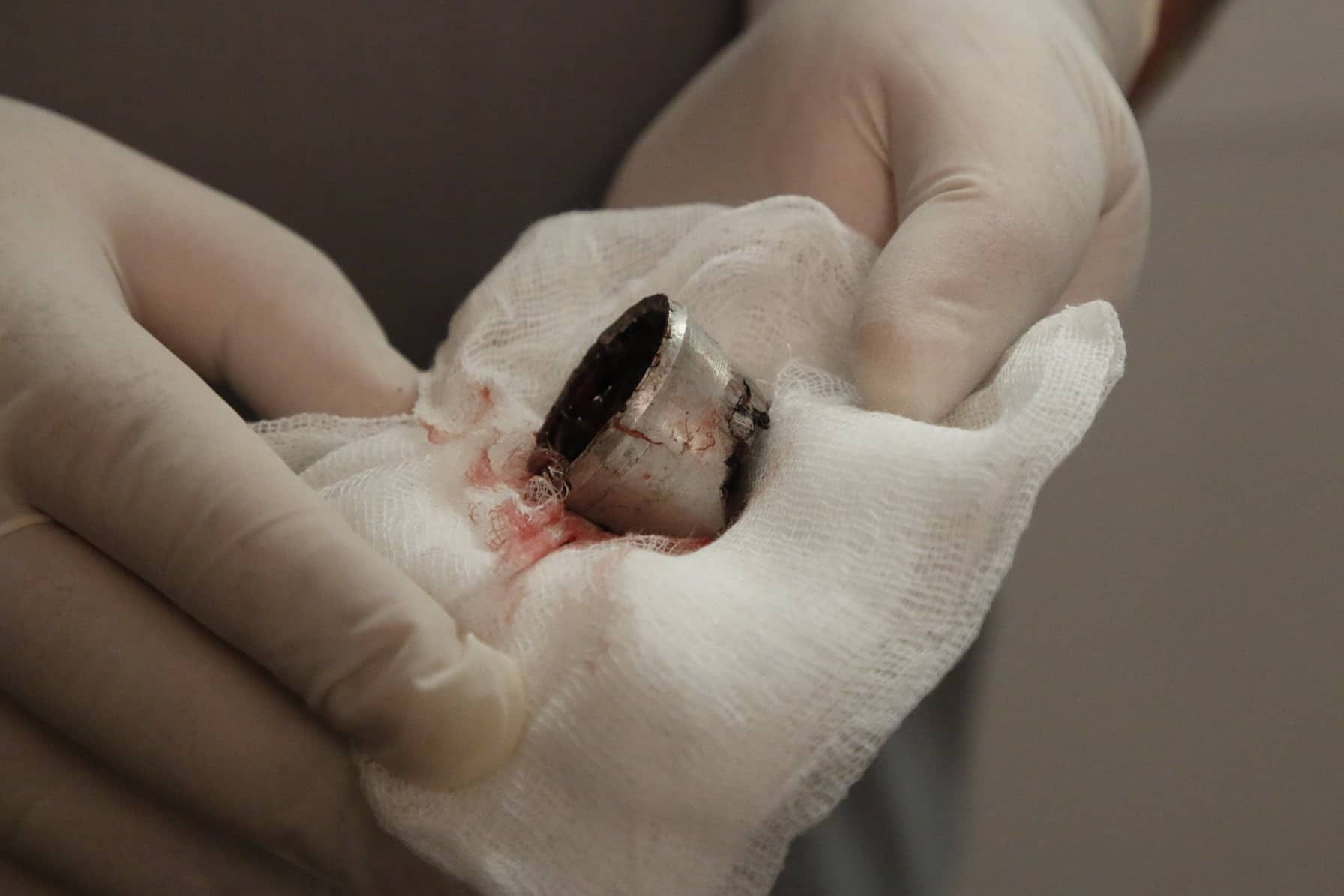 Взрыв под Днепром: пострадали 6 детей. Новости Днепра