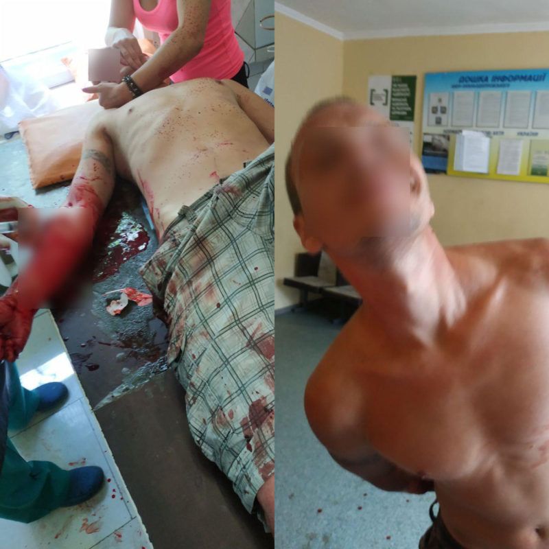 Окровавленного мужчину медикам передали патрульные. Новости Днепра