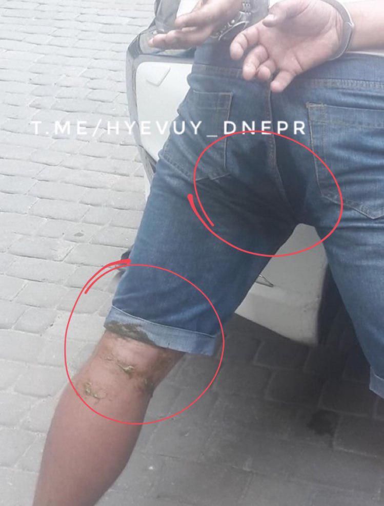 Избиение и стрельба на Солнечном: желудок дебошира не выдержал задержания. Новости Днепра