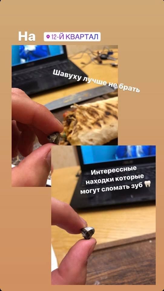 Опасная шаурма: из-за «вкусной» покупки днепрянин чуть не остался без зубов. Новости Днепра