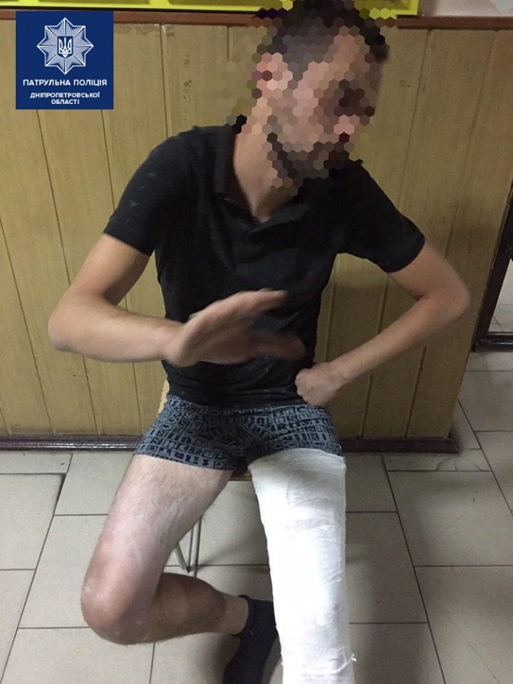 Мгновенная карма: мужчина ограбил днепрянина, но вскоре повредил ногу в погоне с полицией. Новости Днепра