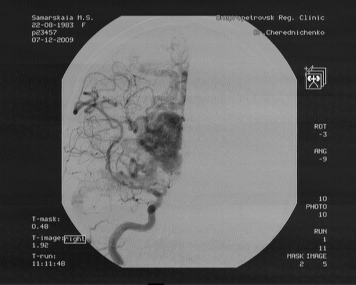 Девушка из Каменского нуждается в помощи