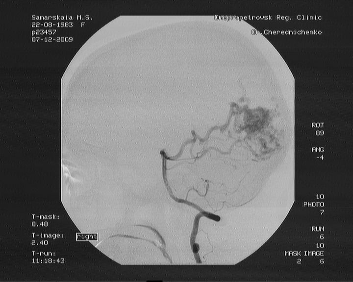 Девушка из Каменского нуждается в помощи