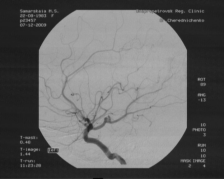 Девушка из Каменского нуждается в помощи