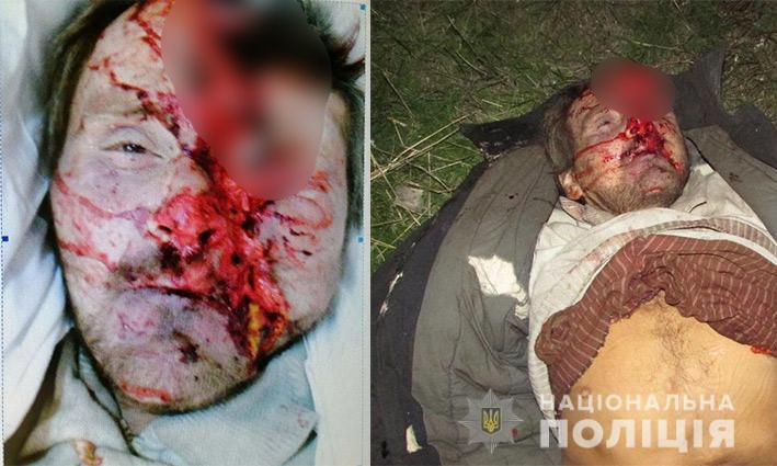 Жуткие травмы головы: помогите опознать погибшего в ДТП. Новости Днепра