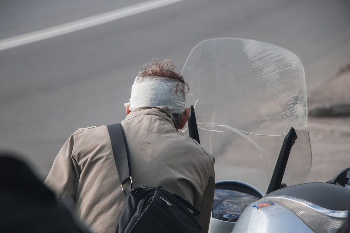 В Днепре подросток попал под колеса скутера. Новости Днепра