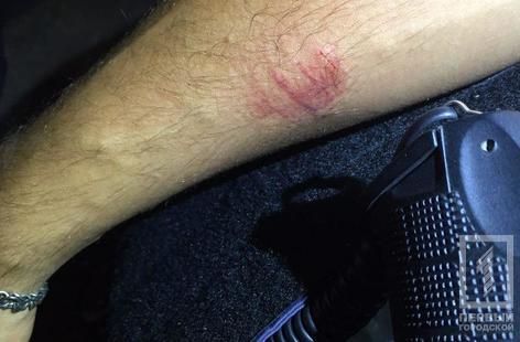 Неадекватный мужчина покусал полицейского: подробности. Новости Днепра