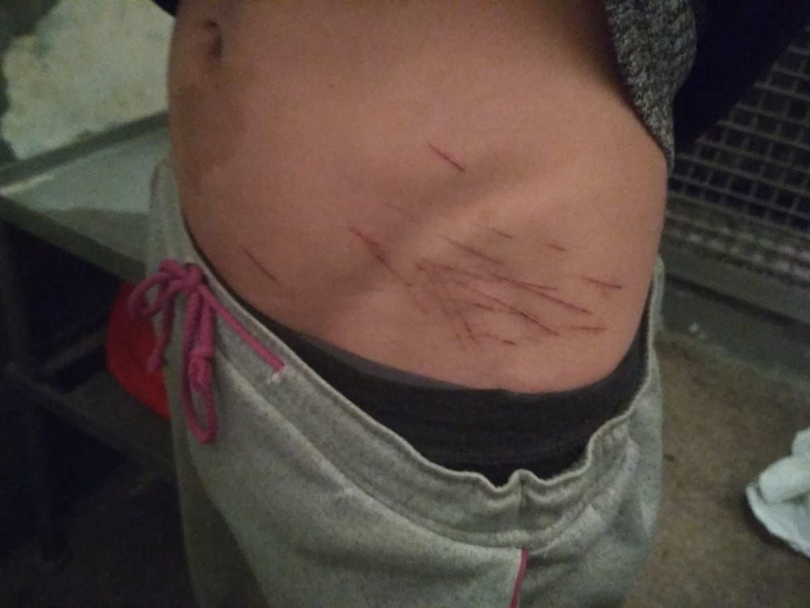 Побои, туберкулез, пытки и просроченные продукты: как содержат заключенных в Днепре. Новости Днепра