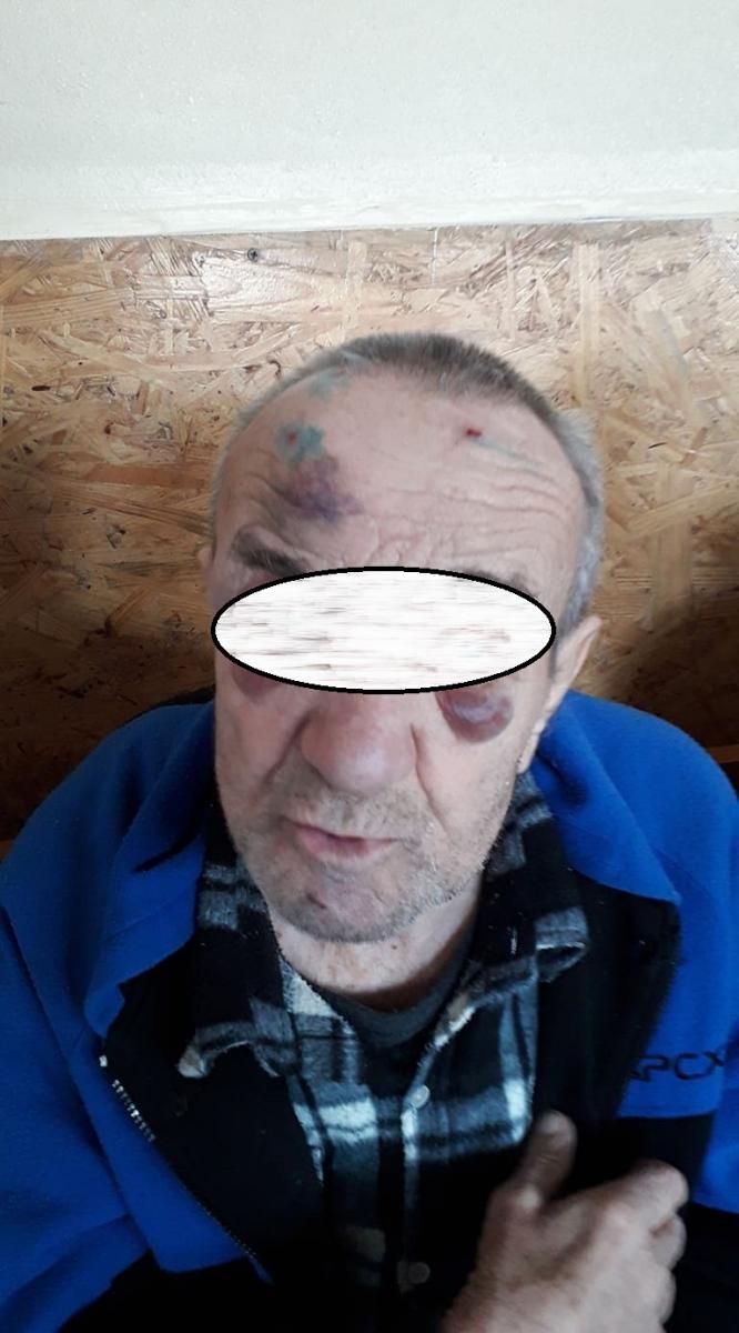 Били и заставляли заниматься сексом: в психоневрологическом интернате области мучают людей. Новости Днепра