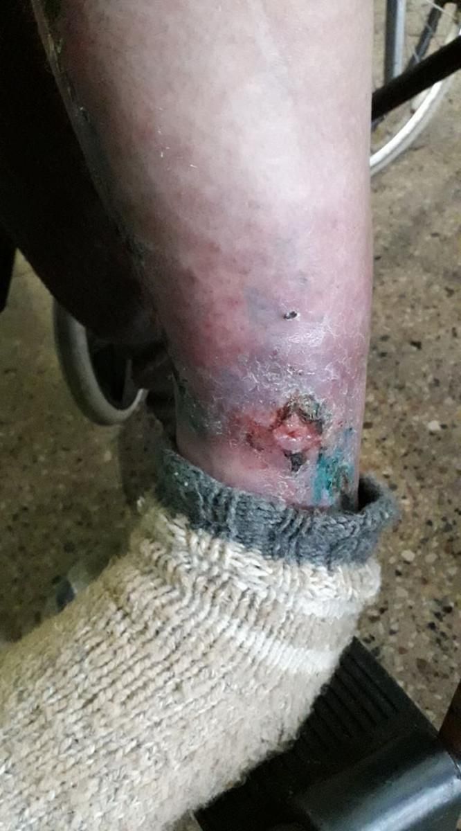 Били и заставляли заниматься сексом: в психоневрологическом интернате области мучают людей. Новости Днепра