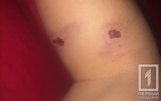 Ребенка искусала собака. Новости Днепра