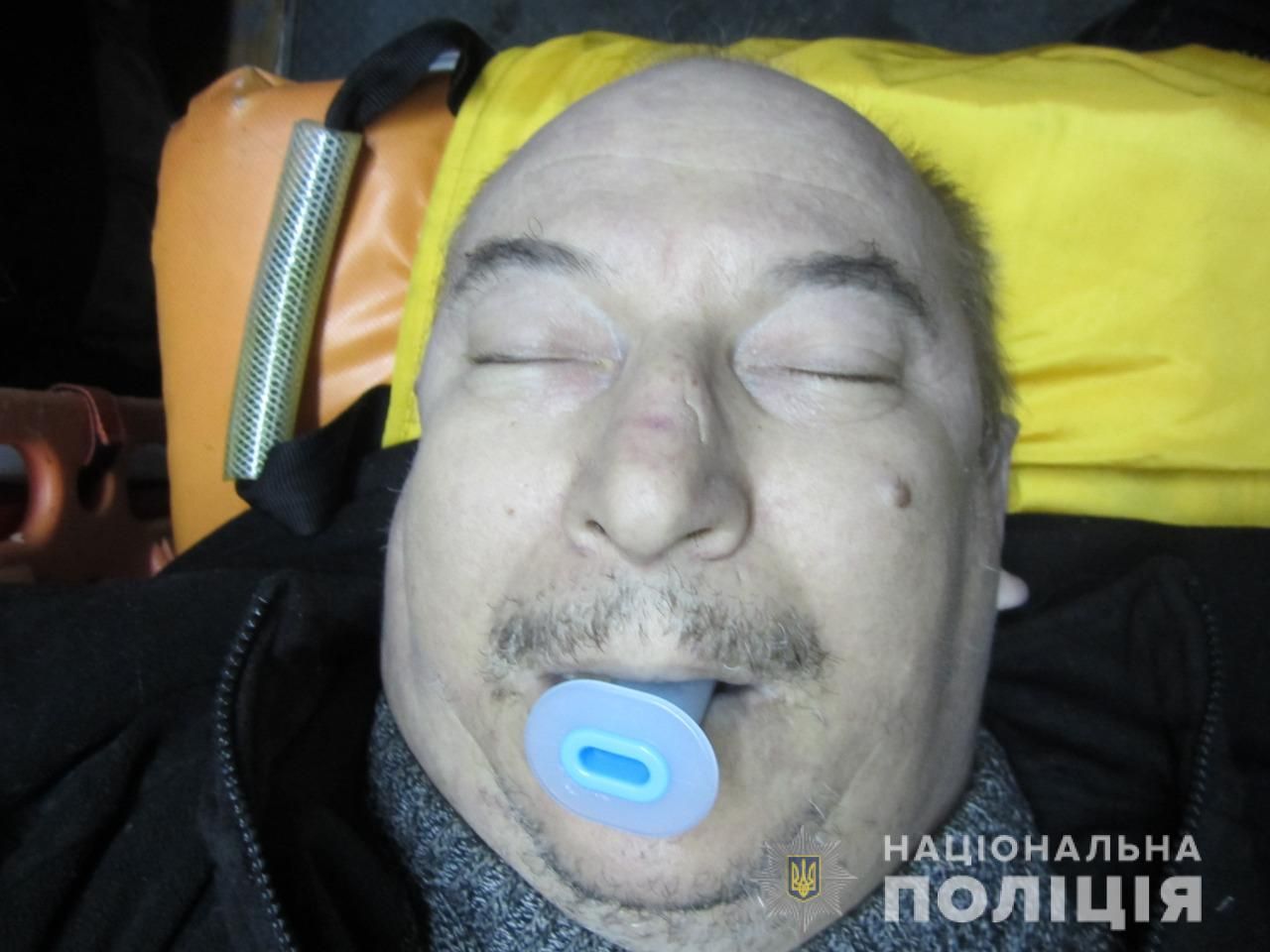 Помогите опознать: в Днепре найдено тело мужчины. Новости Днепра