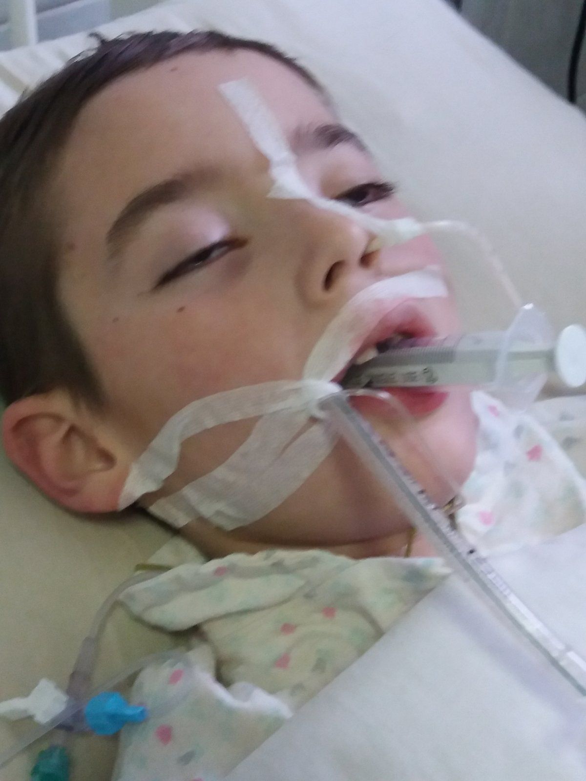 Ребенку, перенесшему асфиксию и кому, нужна помощь