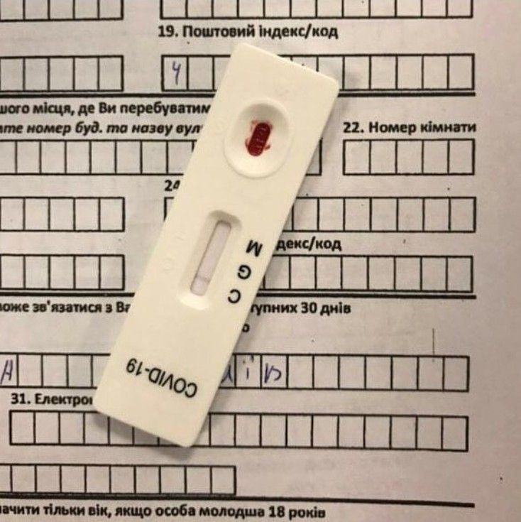 Днепропетровская область получила экспресс-тесты на коронавирус. Новости Днепра