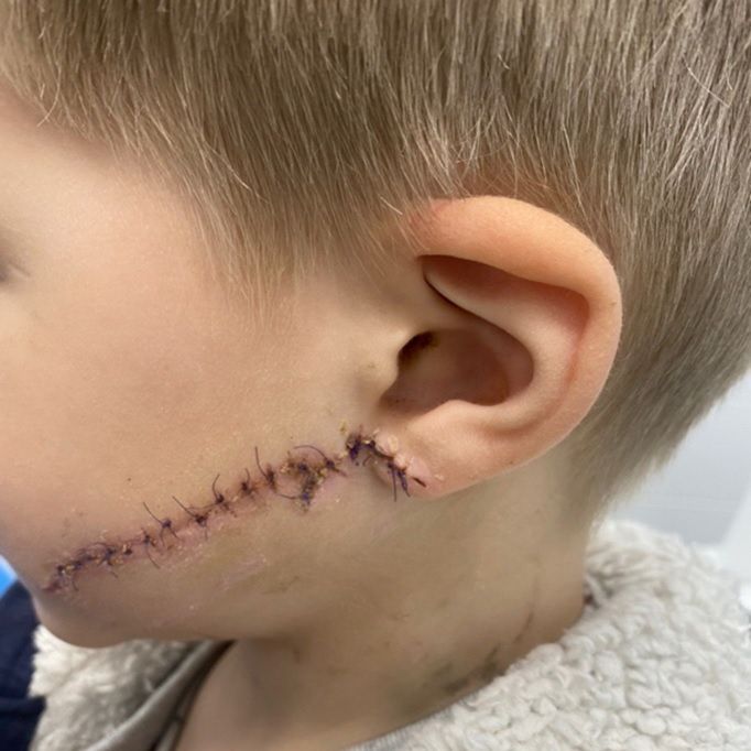 В Днепре домашняя собака укусила ребенка за лицо. Новости Днепра