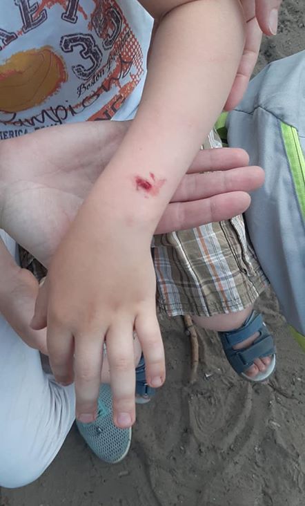 собака ребенок Днепр