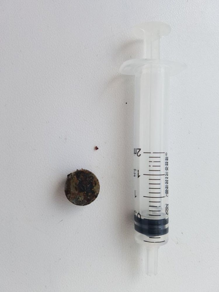 ребенок батарейка нос Днепр