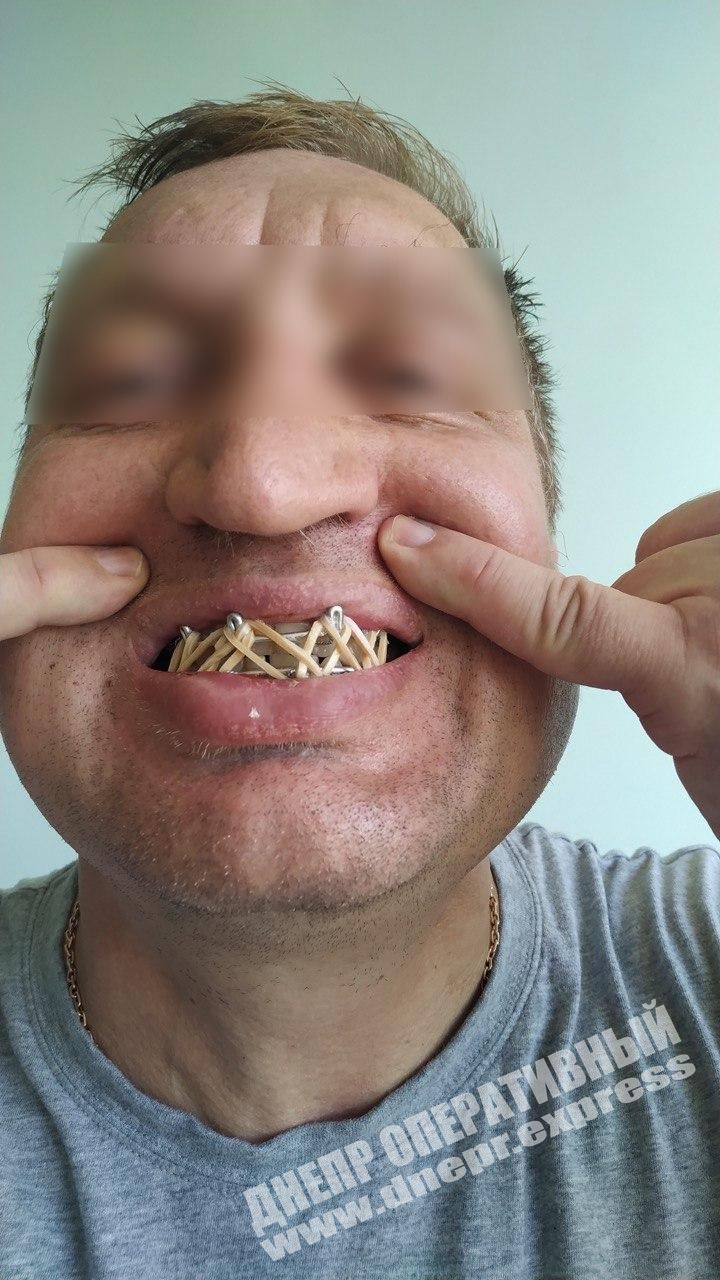 Мужчина, защищавший свою дочь, был жестоко избит. Новости Днепра