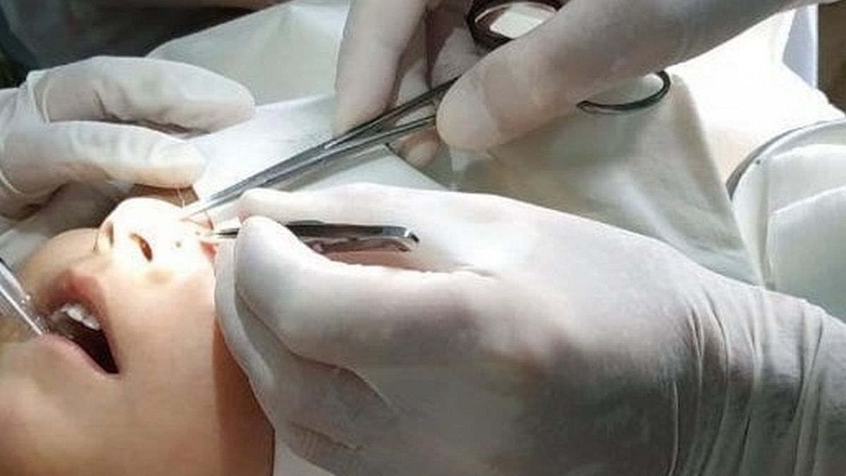 В Днепре девочка упала лицом на острый предмет. Новости Днепра