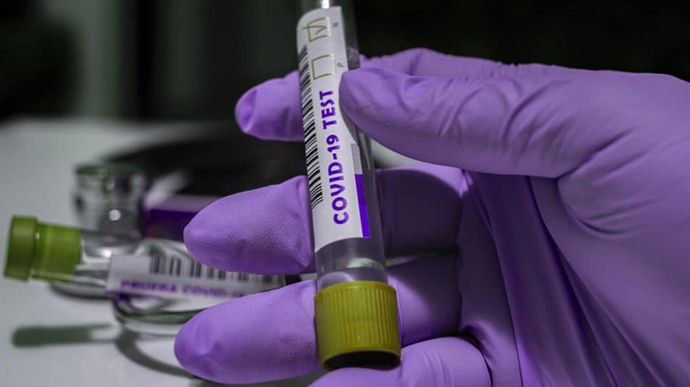 За прошедшие сутки было зафиксировано меньше случаев коронавирусной инфекции, чем за предыдущие. Новости Украины