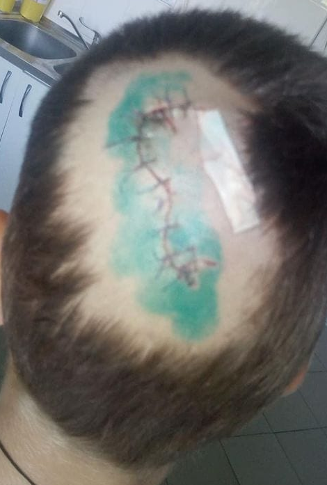 Собака покусала малыша. Новости Днепра