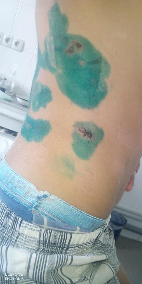 Собака покусала малыша. Новости Днепра