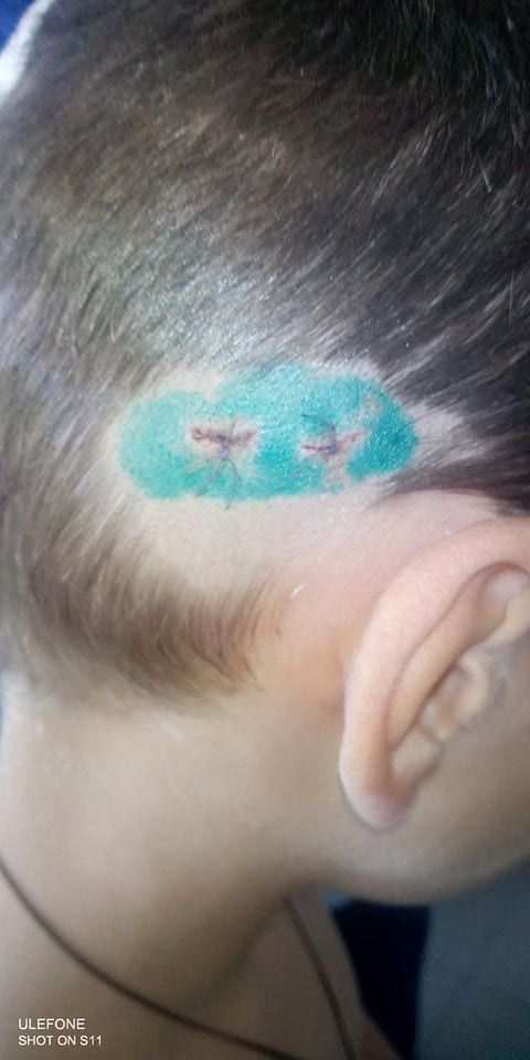 Собака покусала малыша. Новости Днепра