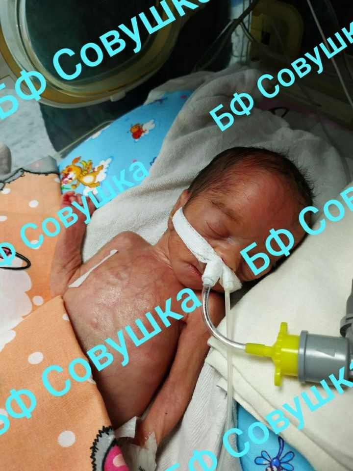 В области спасают жизнь недоношенного ребенка. Новости Днепра