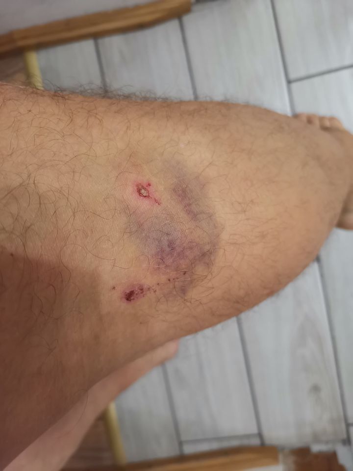 Напала собака. Новости Днепра