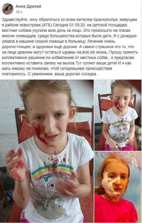 В области собака напала на ребенка. Новости Днепра