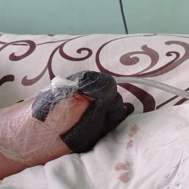 Девочке на ногу упала плита. Новости Днепра