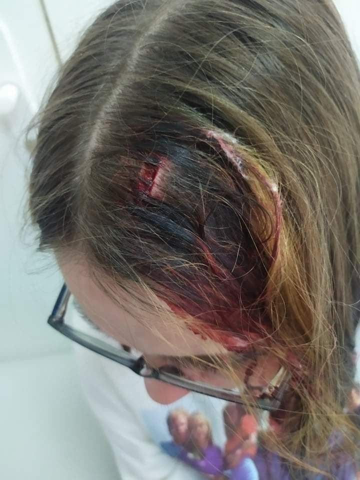 В регионе избили школьницу. Новости Днепра