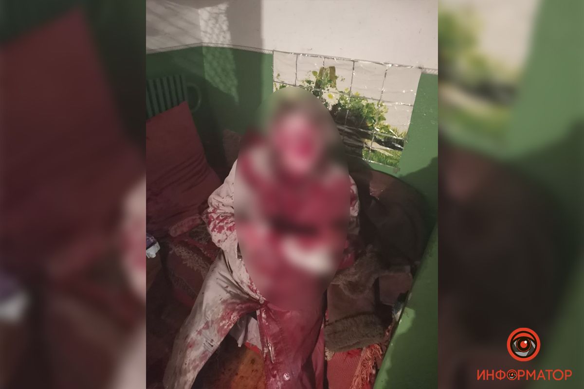 Бил чайником. Новости Днепра