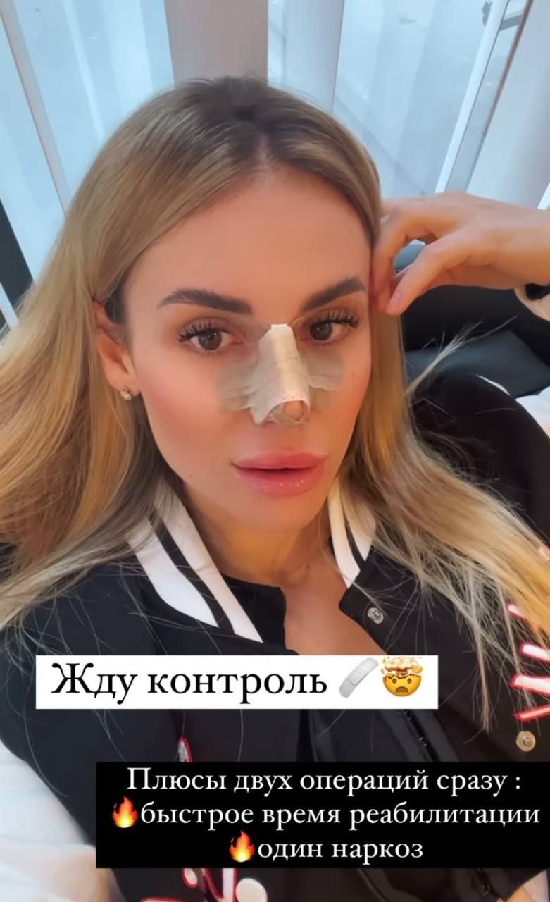 Блогер из Днепра сделала пластическую операцию по увеличению груди в Турции. Новости Днепра