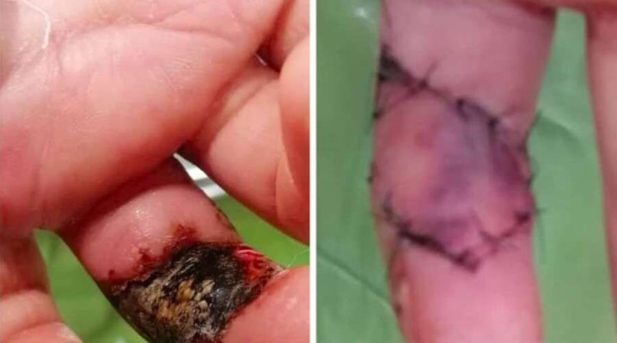 Маленькой девочке. Новости Днепра