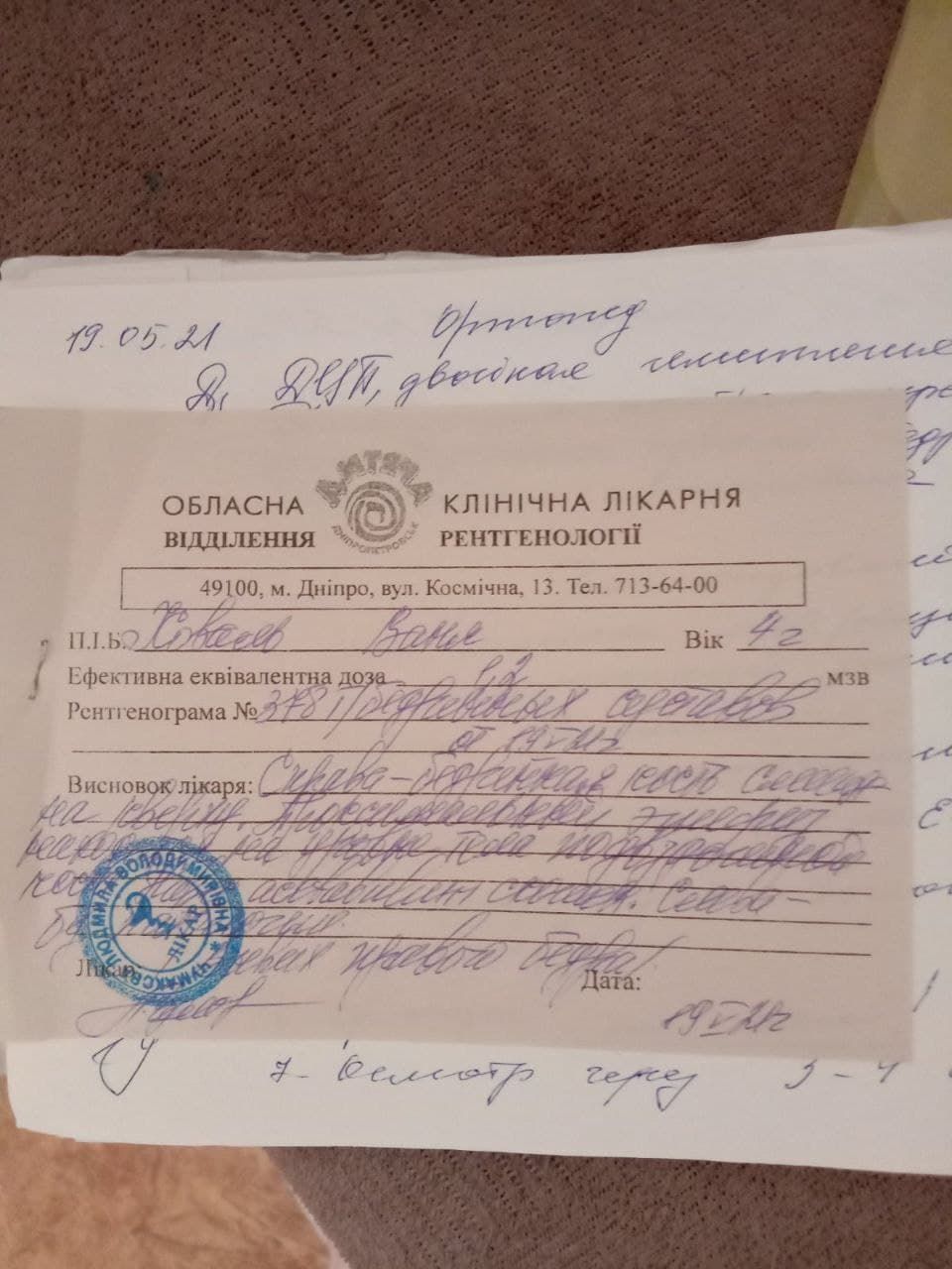 спастический тетрапарез