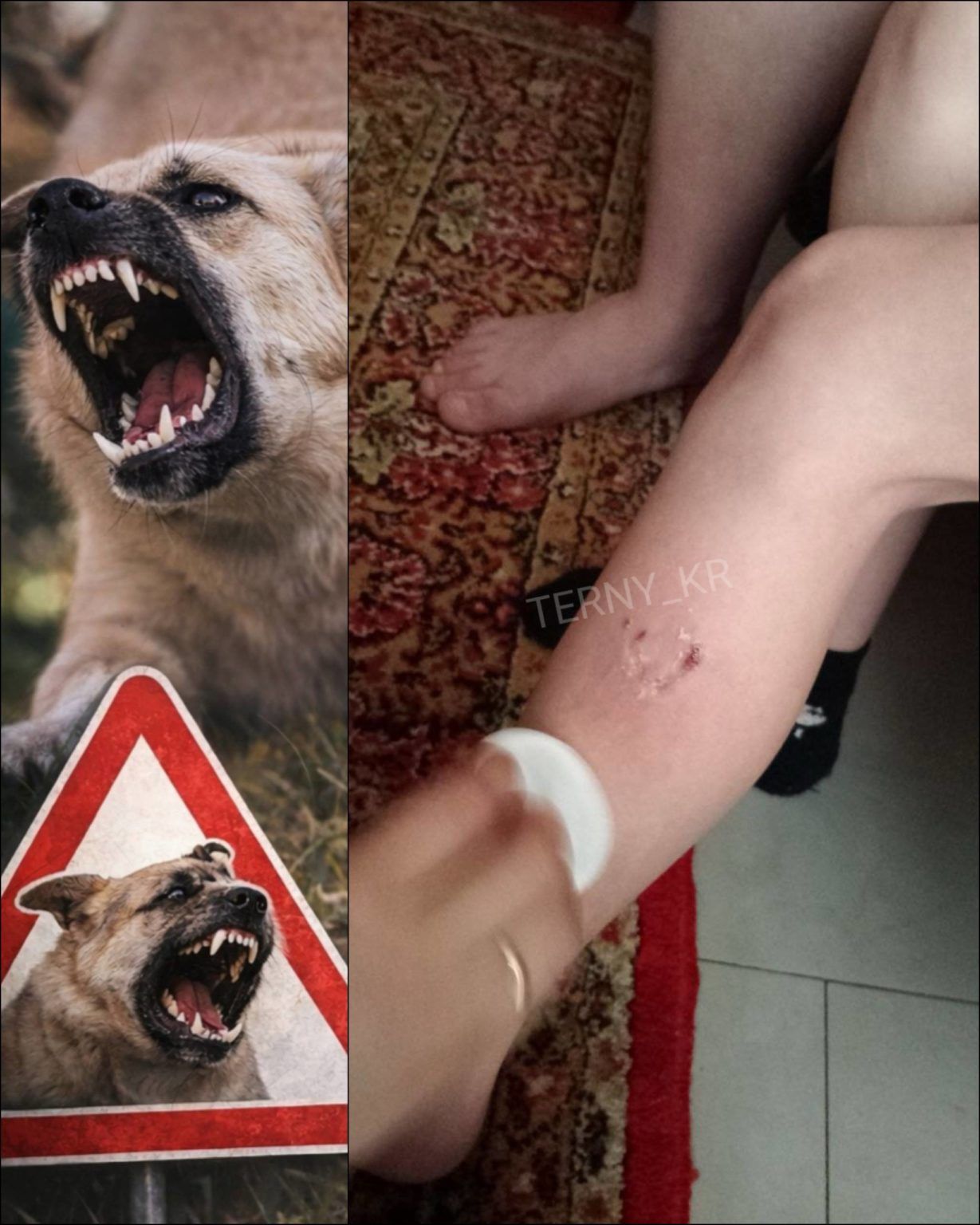 Собака вкусила дитину