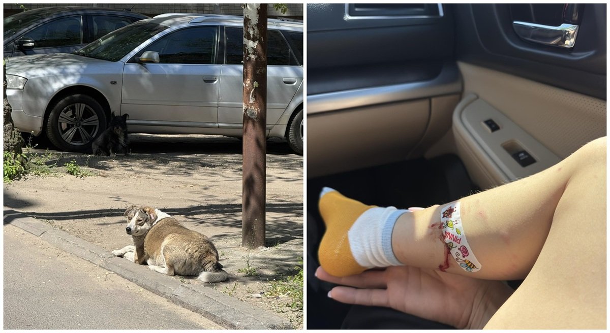 Собака-55 Сквер в Днепре у Косиора, где собака укусила ребенка, нападение животного на мальчика.