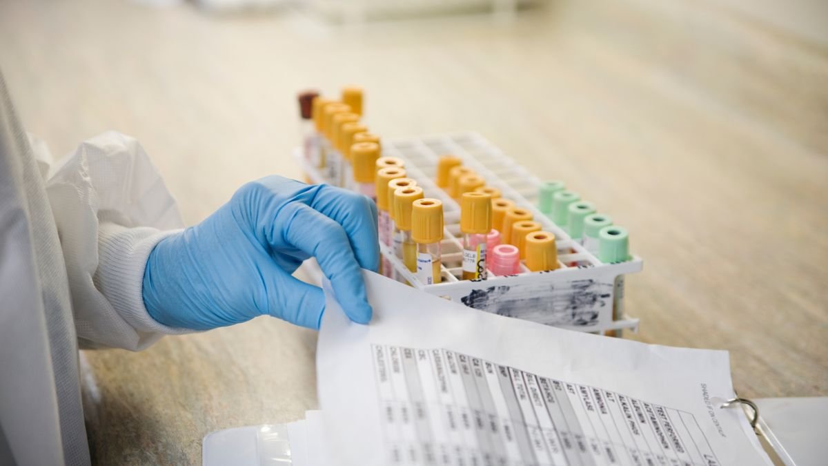 _a_analizi_laboratoriya_probirki_paperi_gettyimages_200571351_001_0bb1736cc3009431e39111c42f05f365_1200x675 Исследование