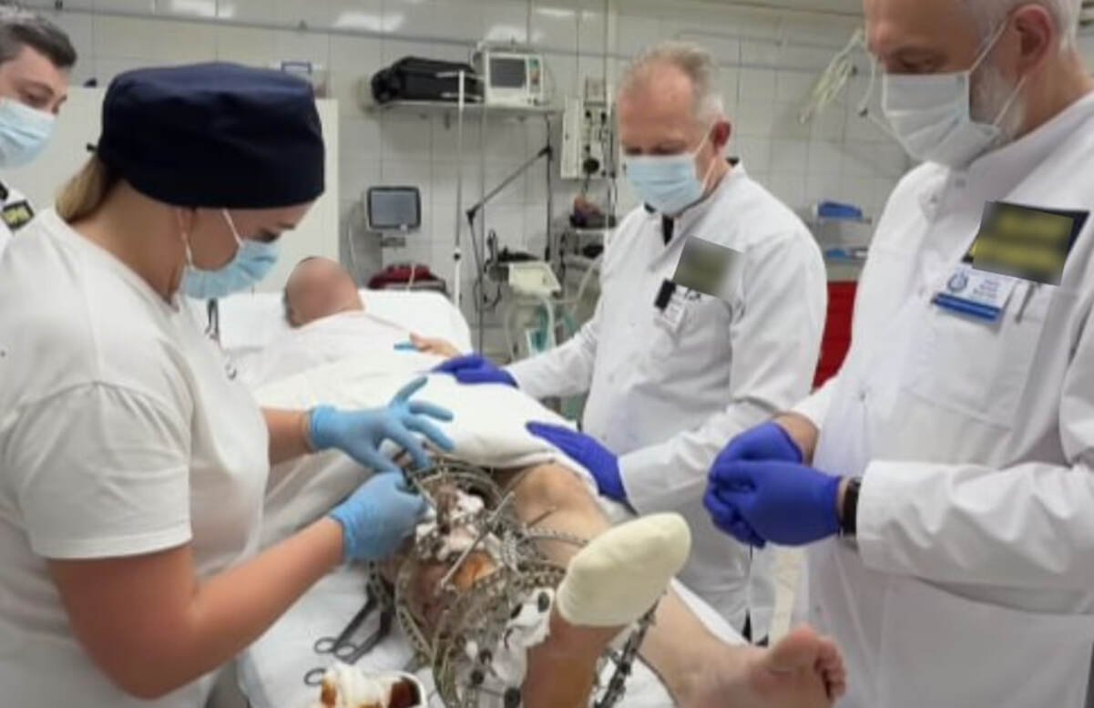 Пережил 24 операции: врачи Днепра сохранили ногу бойцу после тяжелого ранения