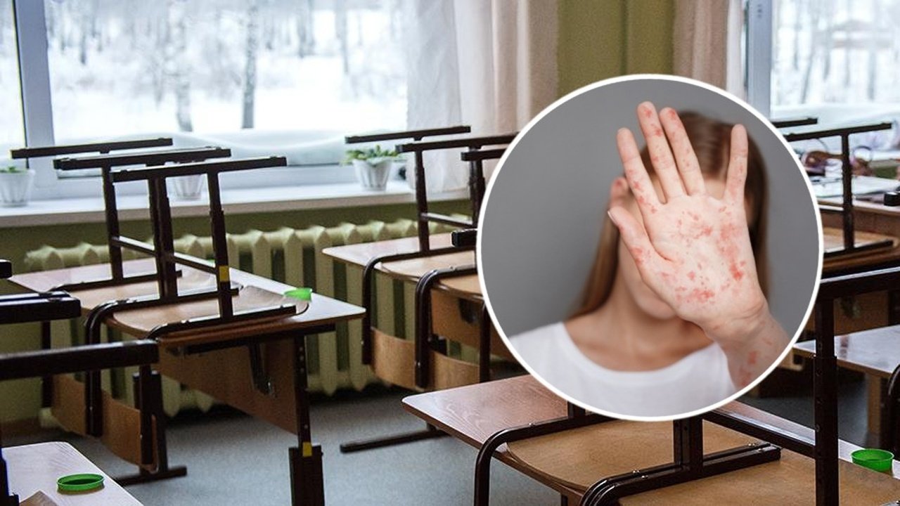 Вспышка кори