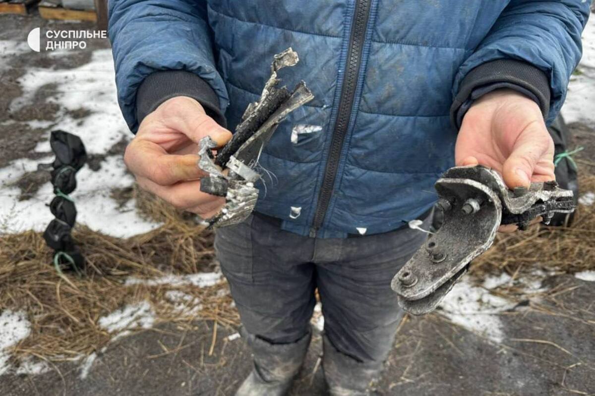 Стали известны новые детали о состоянии раненого мальчика после обстрела Днепровского района