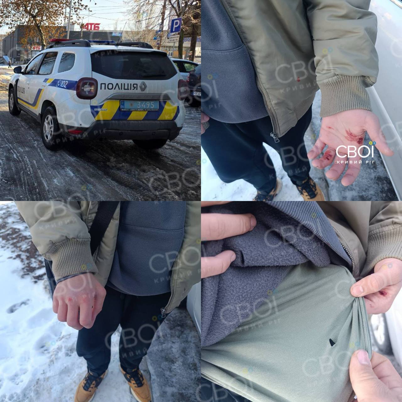 В Кривом Роге мужчина в балаклаве напал с ножом на 17-летнего парня