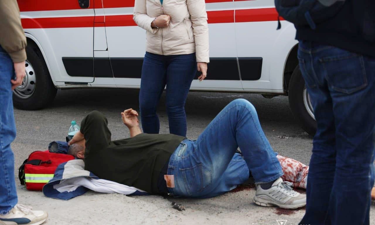 Постраждалий внаслідок атаки чоловік