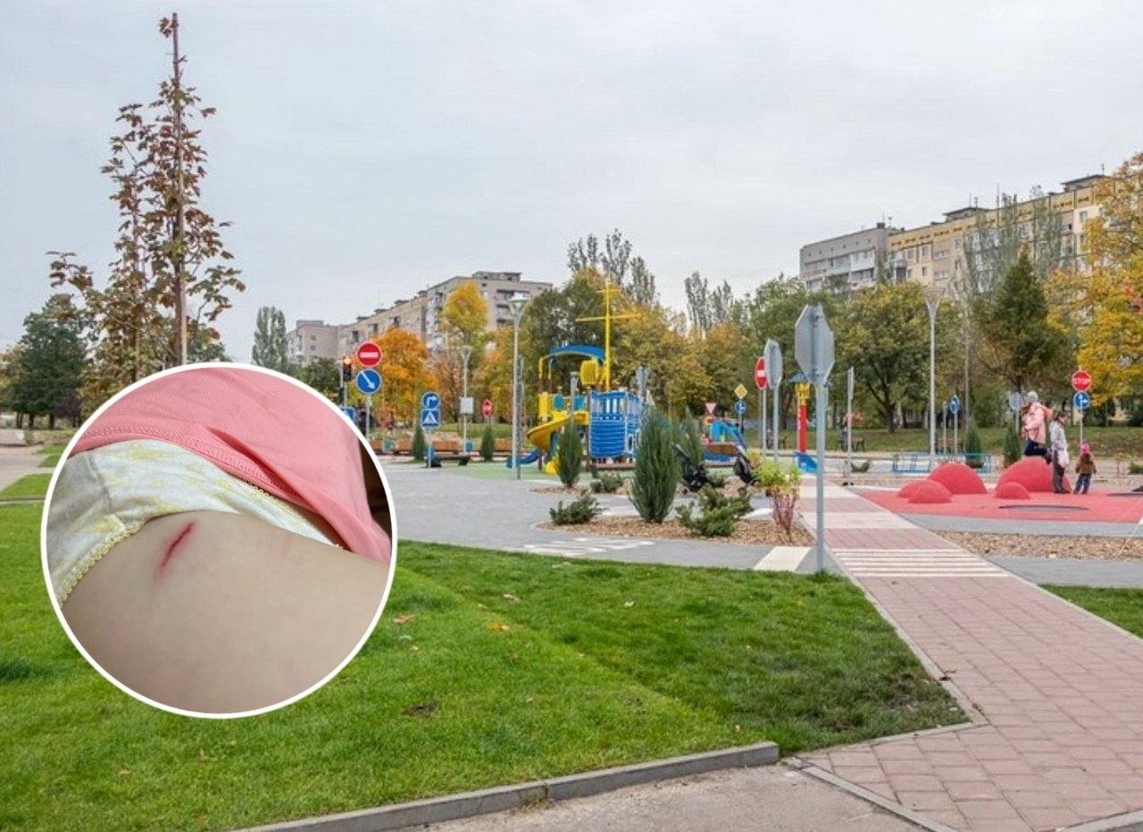 Собака, по словам матери, укусила ее ребенка в парке Усачева